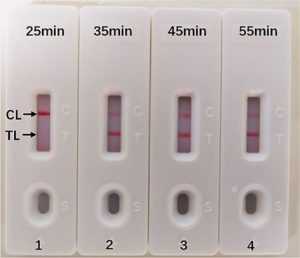 Nuevos test de ensayo de amplificación de desplazamiento cruzado múltiple (MCDA-LFB) para la detección clínica de Legionella pneumophila